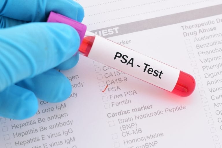 gloved hand holding blood sample PSA test